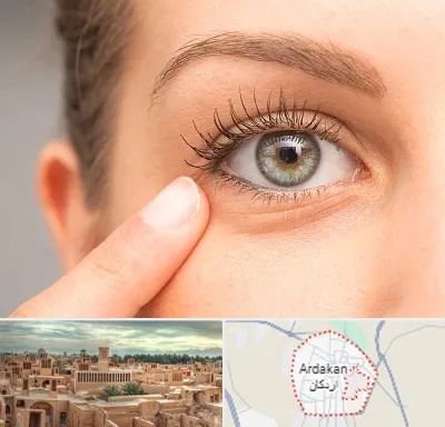 جراح پف چشم در اردکان