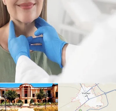 جراح سرطان گلو در خمین