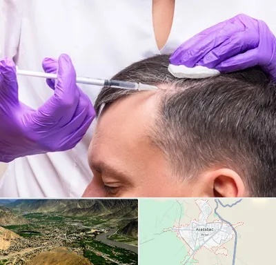 دکتر فوق تخصص پوست و مو در اسدآباد