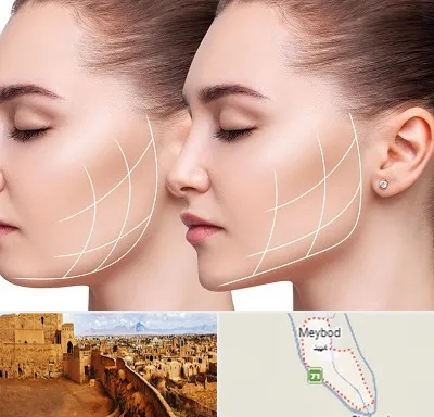 جراحی بوکال فت در میبد