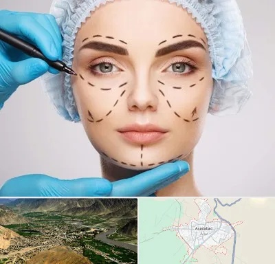 جراح پلاستیک در اسدآباد
