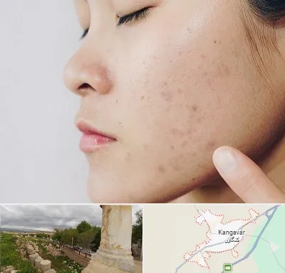 دکتر جوش صورت در کنگاور