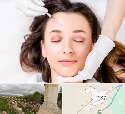 مزوتراپی ابرو در کنگاور