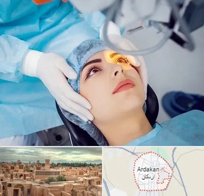 دکتر عمل لیزیک چشم در اردکان
