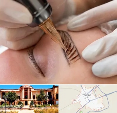 میکروبلیدینگ در خمین