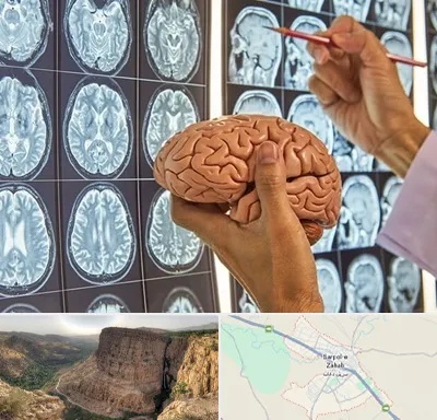 دکتر فوق تخصص جراح مغز و اعصاب در سرپل ذهاب