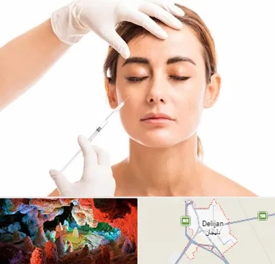تزریق ژل گونه در دلیجان
