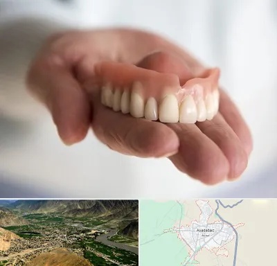 لیفت لثه با لیزر در اسدآباد