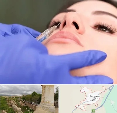 هیالاز در کنگاور