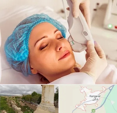 اکسنت در کنگاور