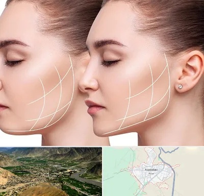جراحی بوکال فت در اسدآباد