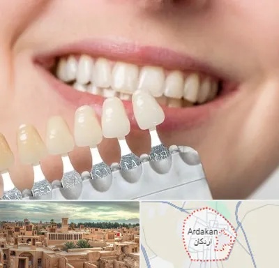 مرکز کامپوزیت دندان در اردکان