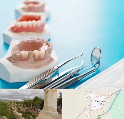 متخصص روکش دندان در کنگاور