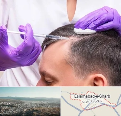 دکتر فوق تخصص پوست و مو در اسلام آباد غرب