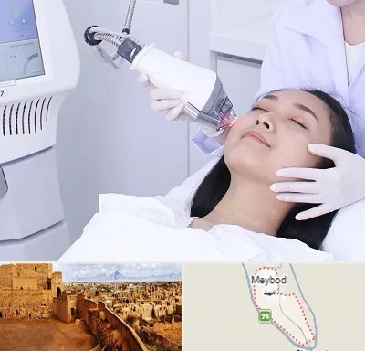 وایتنینگ در میبد