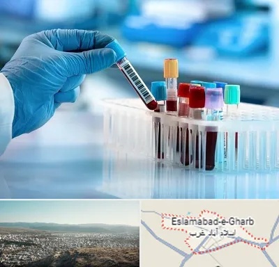 آزمایشگاه خون قبل از ازدواج در اسلام آباد غرب