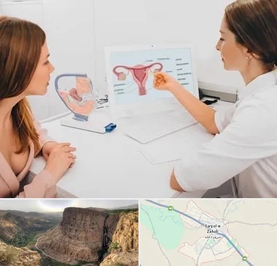 فوق تخصص نازایی در سرپل ذهاب