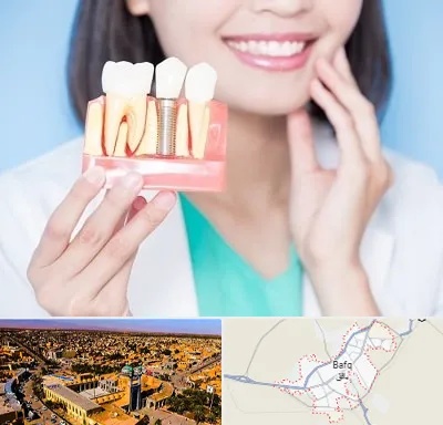 متخصص ایمپلنت در بافق