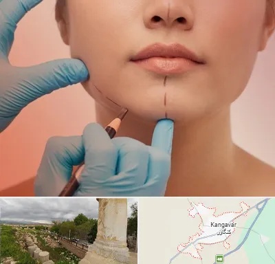 دکتر زیبایی خانم در کنگاور