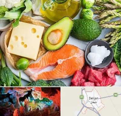 فروشگاه محصولات کتوژنیک در دلیجان