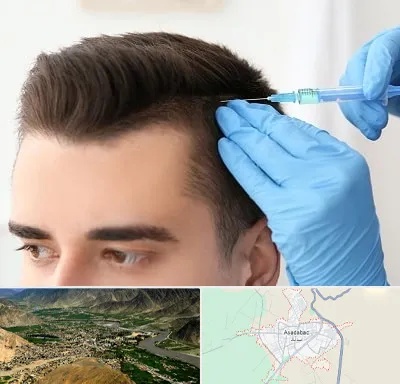 مزوتراپی مو در اسدآباد