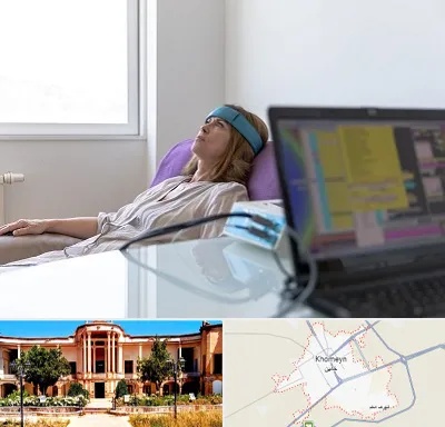 بیوفیدبک در خمین
