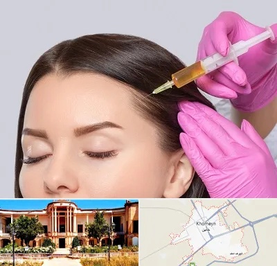 تزریق هیر فیلر در خمین