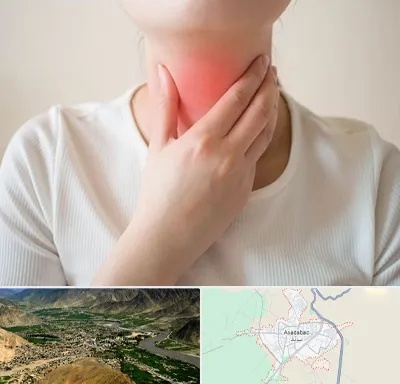 دکتر سرطان مری در اسدآباد