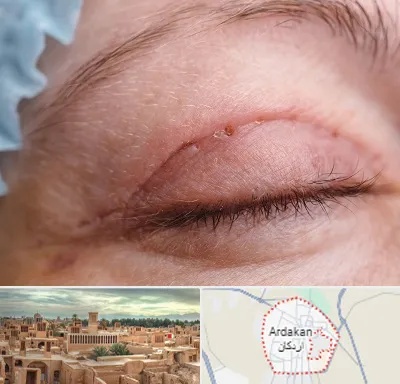 جراح پلک در اردکان