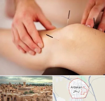دکتر طب سوزنی برای لاغری در اردکان
