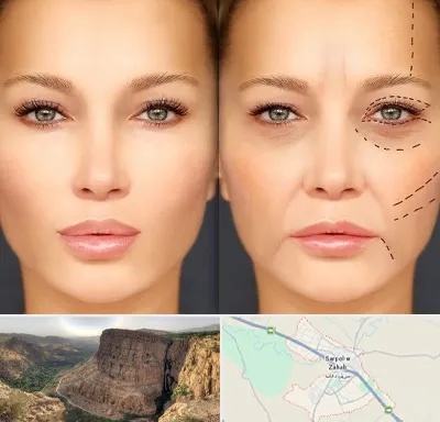 متخصص زیبایی چشم در سرپل ذهاب
