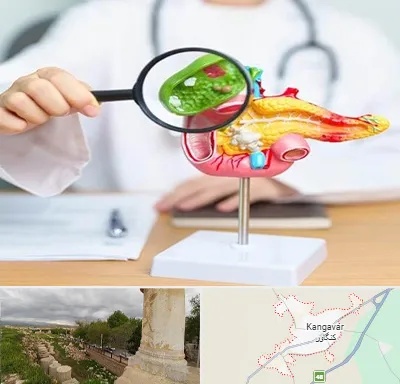 جراح سرطان پانکراس در کنگاور
