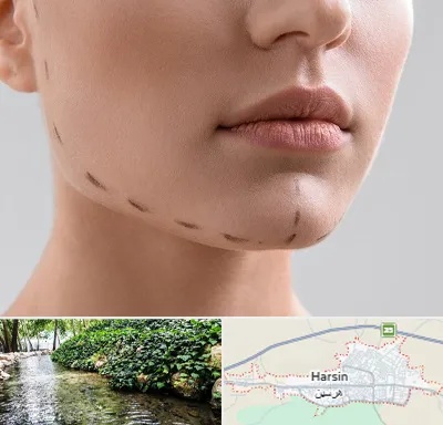 عمل زاویه فک در هرسین