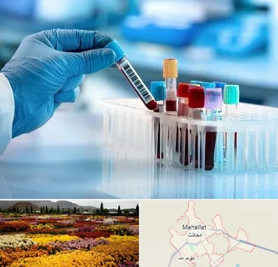 آزمایشگاه خون قبل از ازدواج در محلات