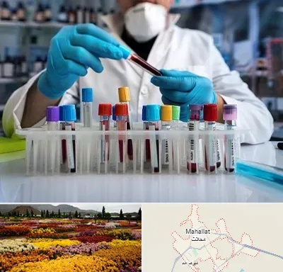آزمایشگاه خون در محلات