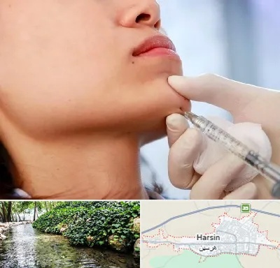 زاویه سازی صورت در هرسین