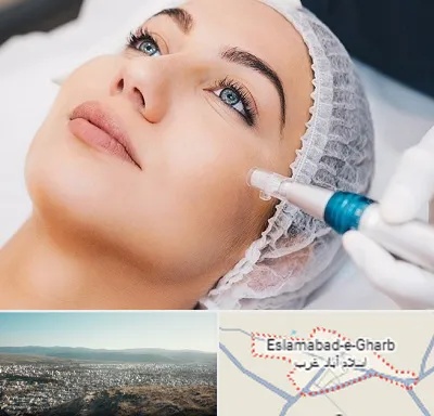 مزونیدلینگ در اسلام آباد غرب