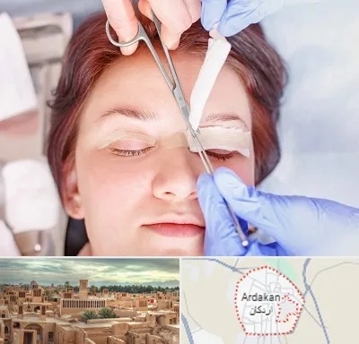 جراحی پلک افتاده در اردکان