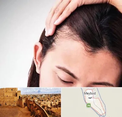 کاشت مو بانوان در میبد