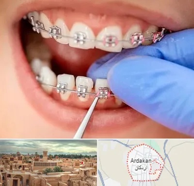 مرکز ارتودنسی دندان در اردکان