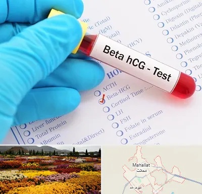 آزمایشگاه بارداری در محلات