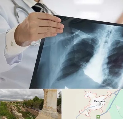 فوق تخصص ریه در کنگاور
