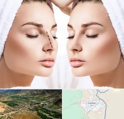 عمل بینی در اسدآباد