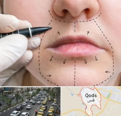 عمل سانترال لب در شهر قدس
