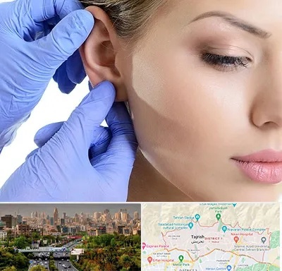 اتوپلاستی در منطقه 1 تهران 