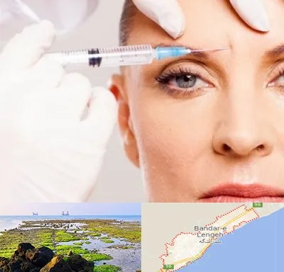 مزوژل در بندرلنگه