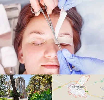 جراحی پلک افتاده در نیشابور