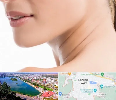 جراحی فک با لیزر در لاهیجان