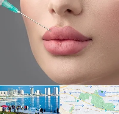 کلینیک ژل لب روسی در چیتگر 