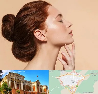جراحی غبغب در خوی